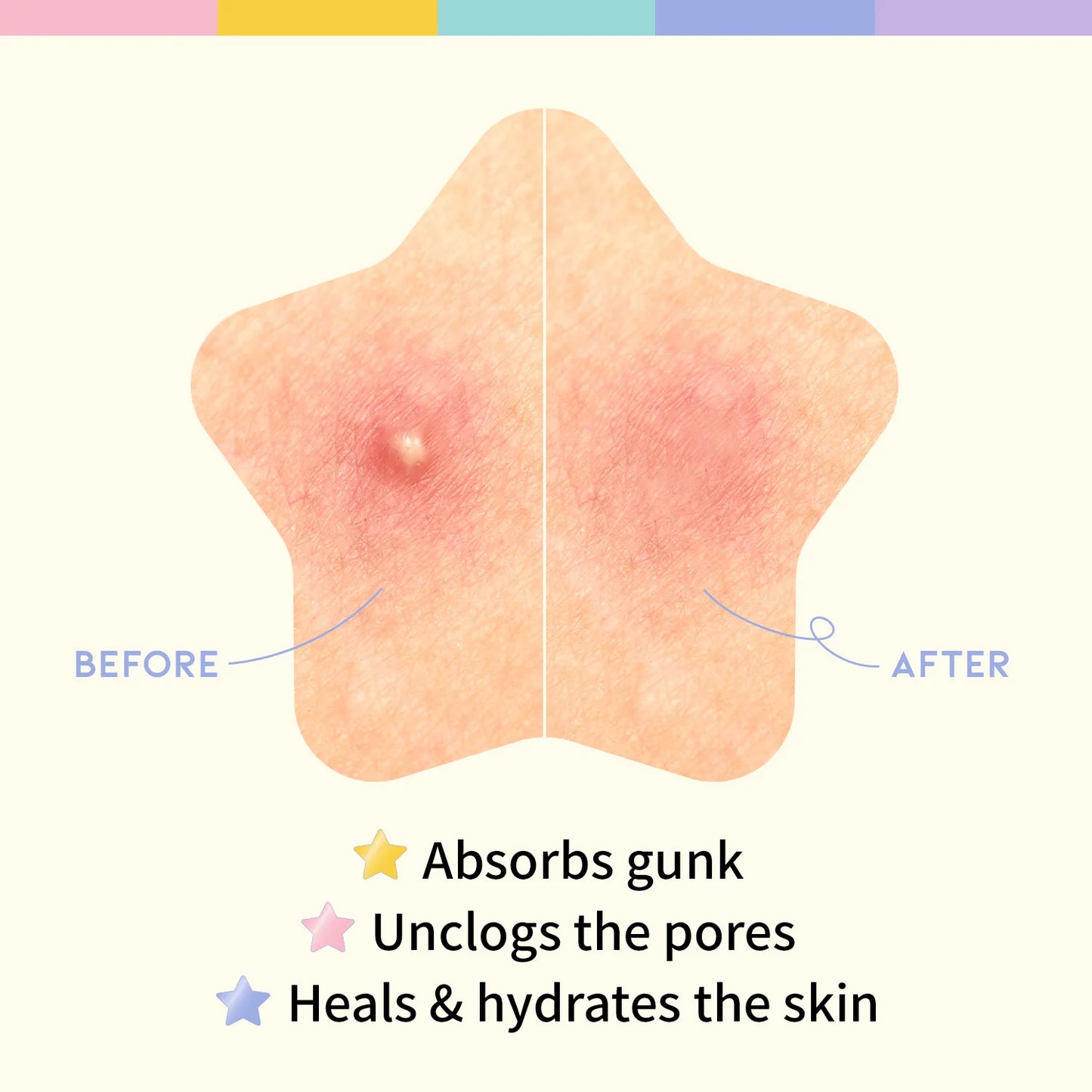 Star Spot Patch (80 Dots)