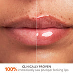 Mini DermInfusions™ Plump + Repair Lip Treatment with Hyaluronic Acid