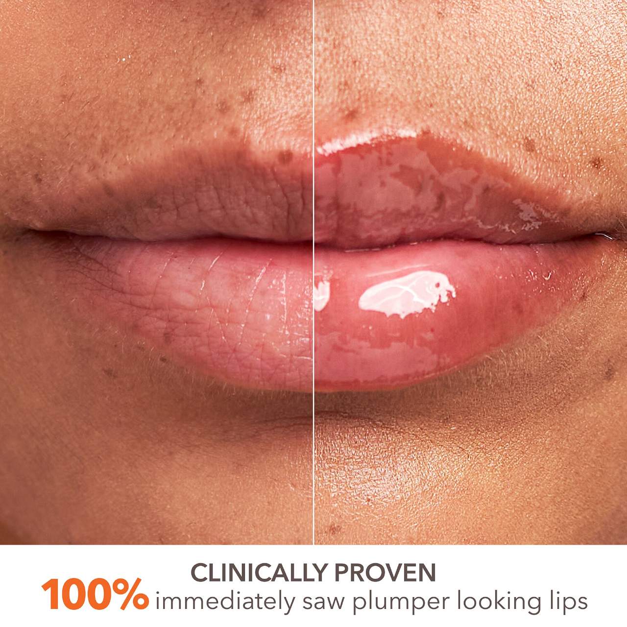 Mini DermInfusions™ Plump + Repair Lip Treatment with Hyaluronic Acid