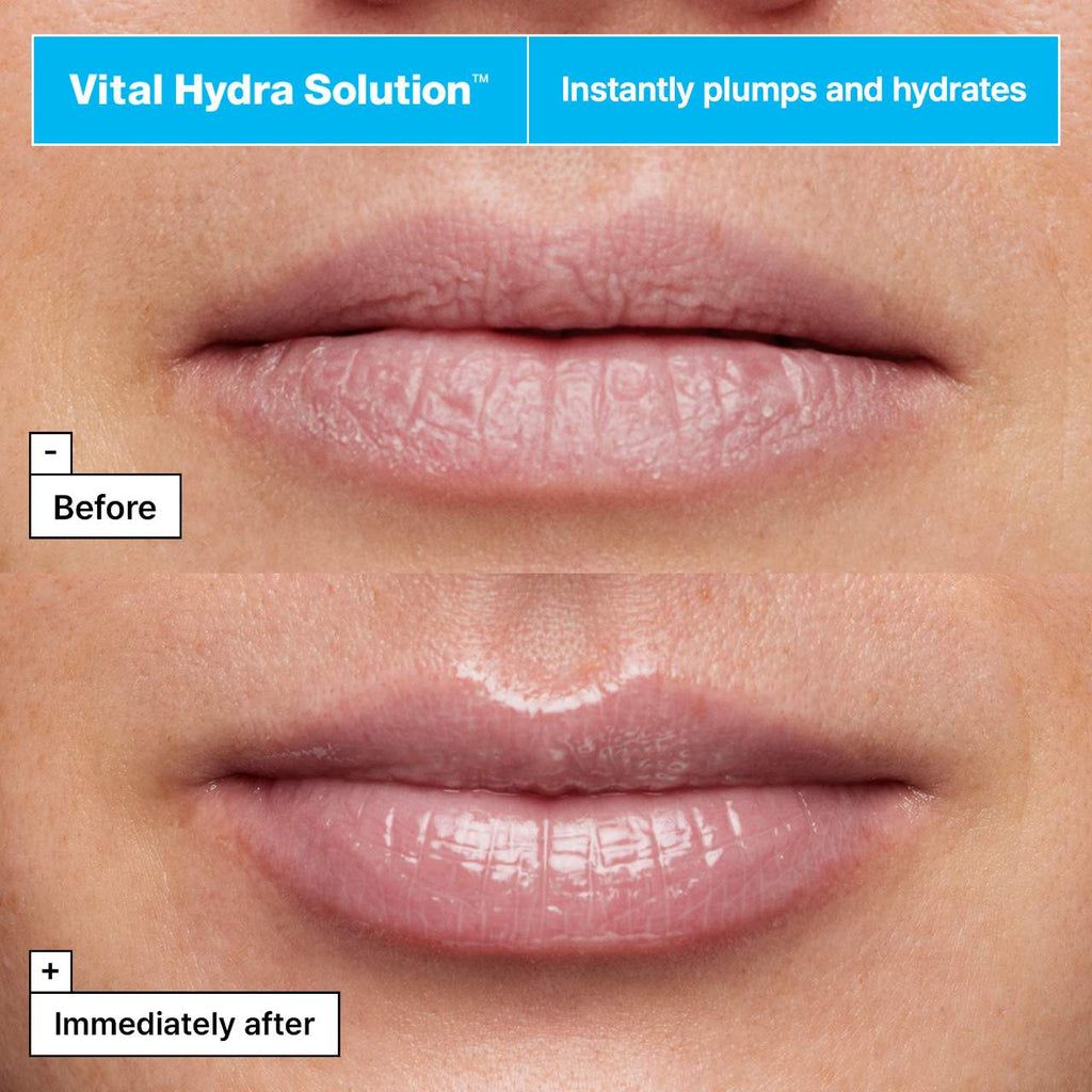 Vital Hydra Solution™ Jelly Bear Lip Mask with Hyaluronic Acid