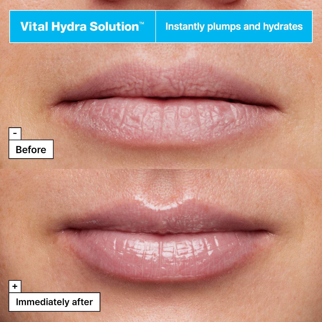 Vital Hydra Solution™ Jelly Bear Lip Mask with Hyaluronic Acid